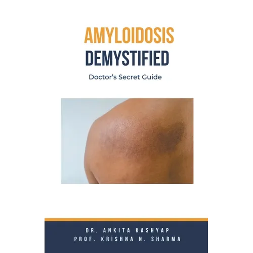 Amyloidosis Demystified: Doctor's Secret Guide - Paperback