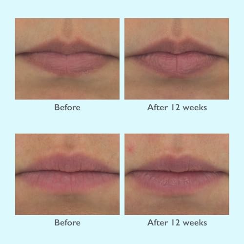 Pro Restorsea LipMagic Exfoliating Lip Scrub For Smoother Softer Lips